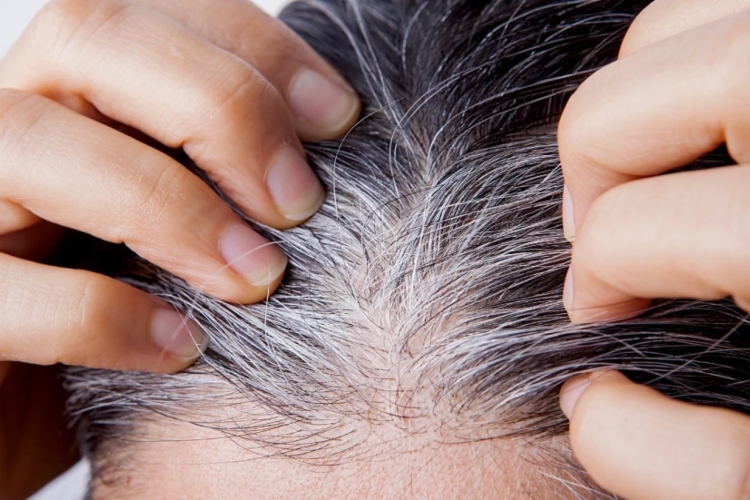 ¿Arrancarse las canas? Esto dice un dermatólogo