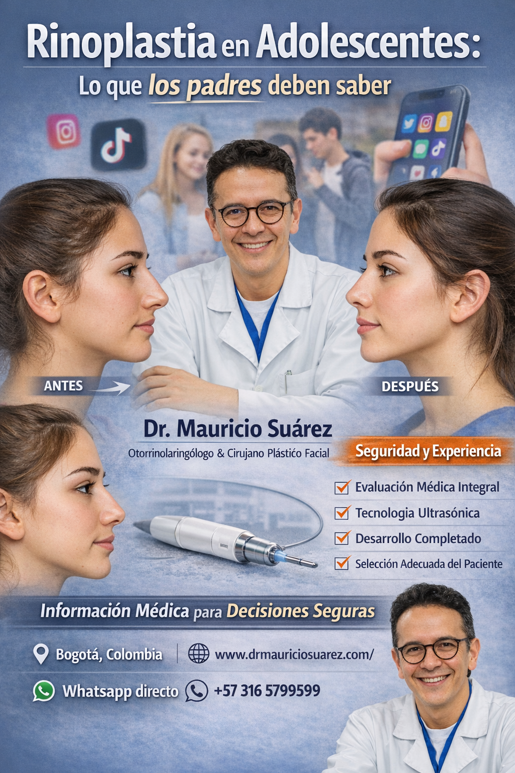 Rinoplastia en adolescentes_ seguridad y experiencia (1)