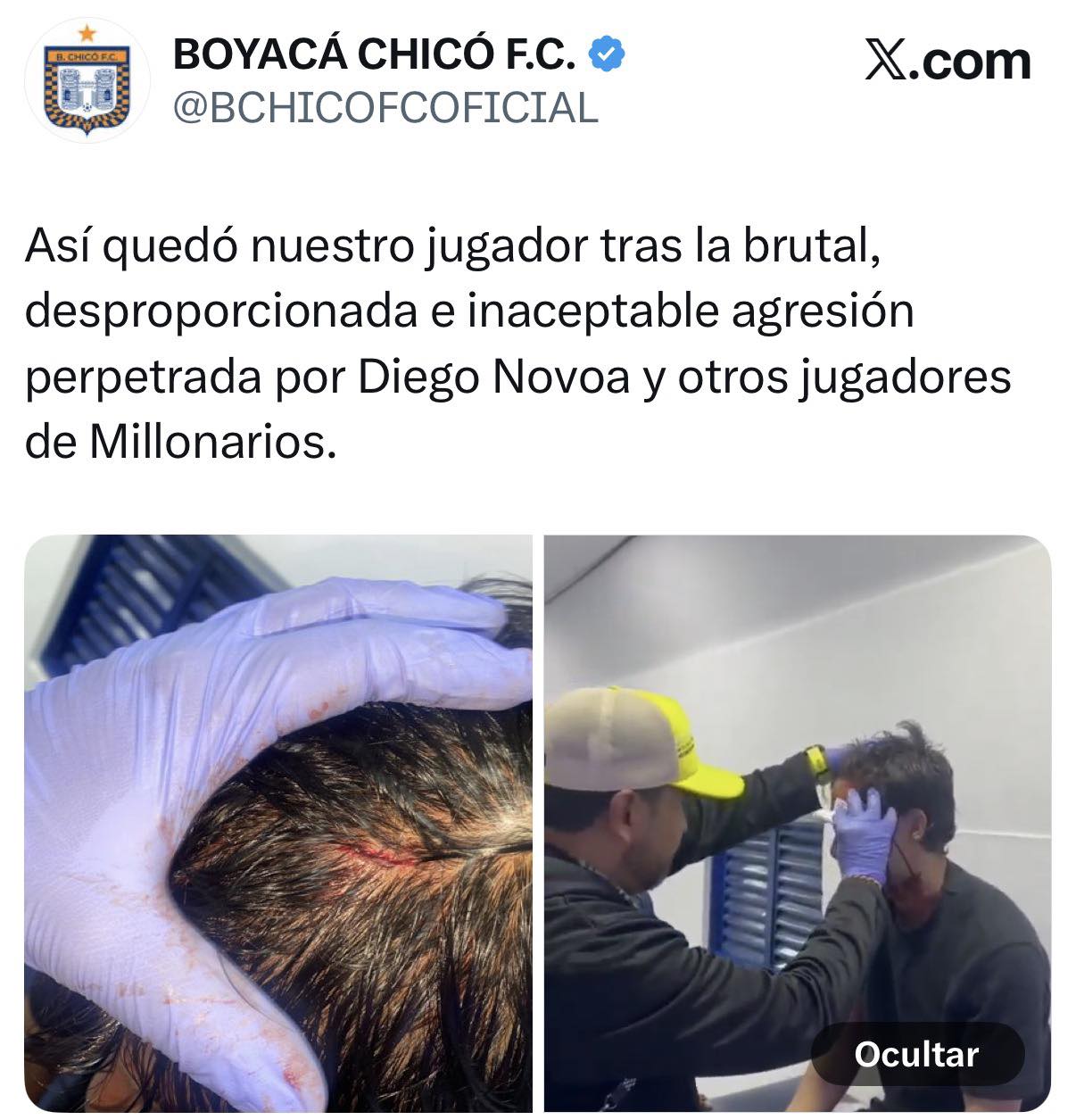 Boyacá Chicó emitió comunicado de prensa por agresiones de jugadores de Millonarios a Jacobo Pimentel