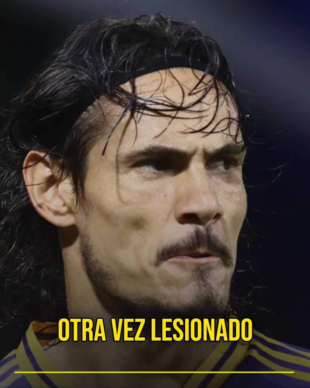 CAVANI