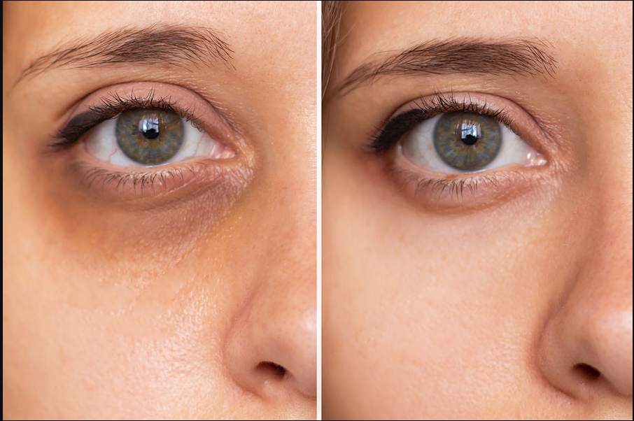 OJERAS PROFUNDAS