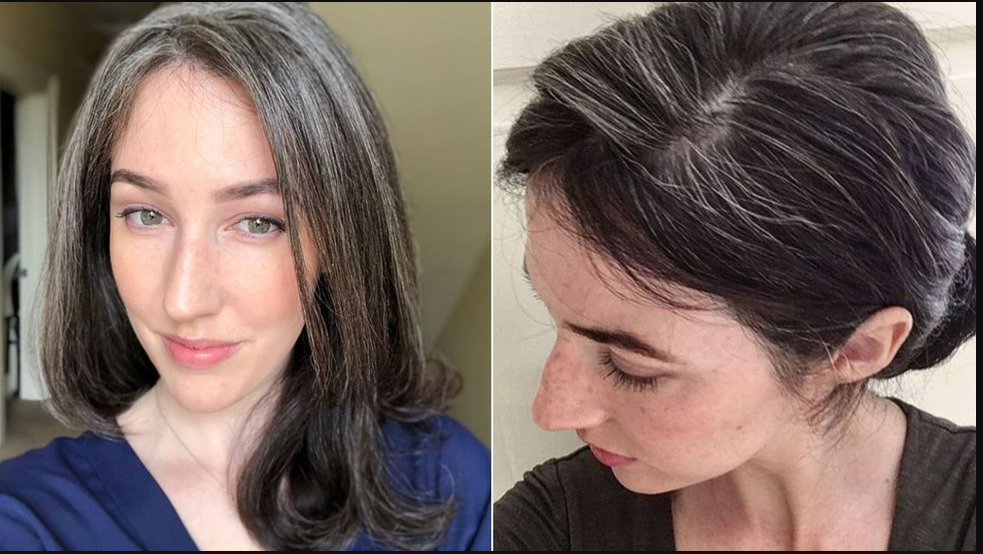 CANAS A TEMPRANA EDAD
