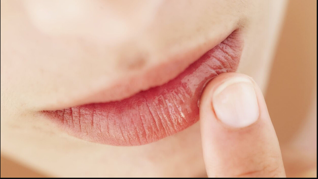 LABIOS RESECOS